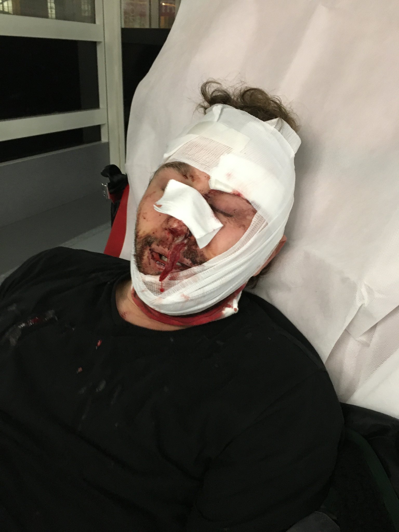 Gesetz zur „globalen Sicherheit“: Ein Fotograf in Paris verletzt – RSF prangert „Polizeigewalt“ an.