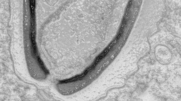 Aus der Wissenschaft: Prähistorische Viren beunruhigen die Forscher