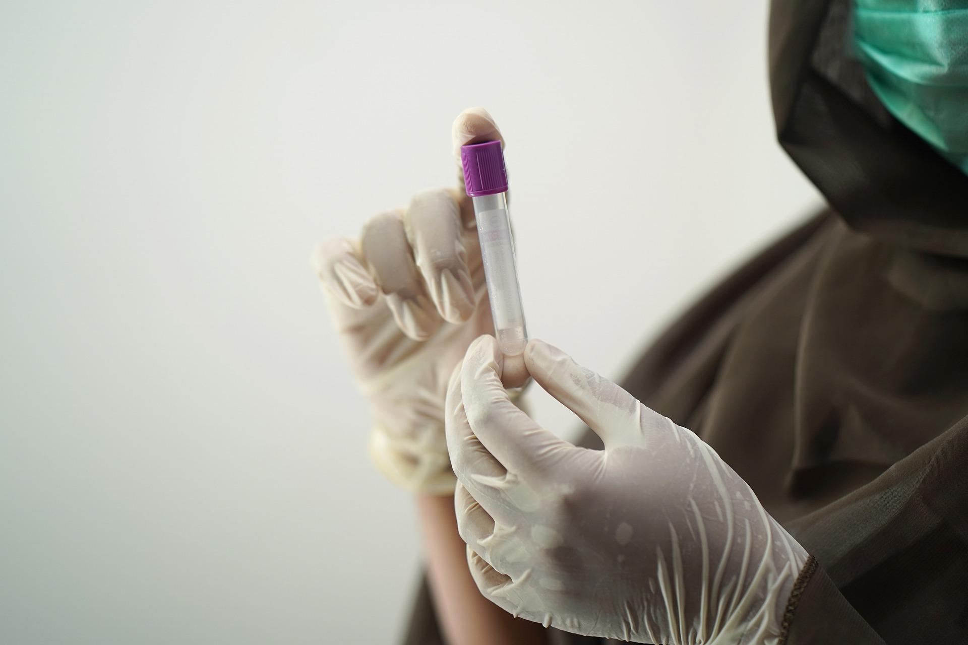 Affenpocken: Erster Fall einer mit dem Monkeypox-Virus infizierten Person in Frankreich