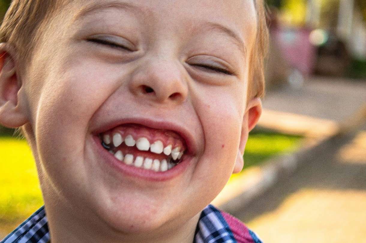 Das Lächeln einer Gesellschaft – Warum Zahngesundheit mehr als nur Kosmetik ist